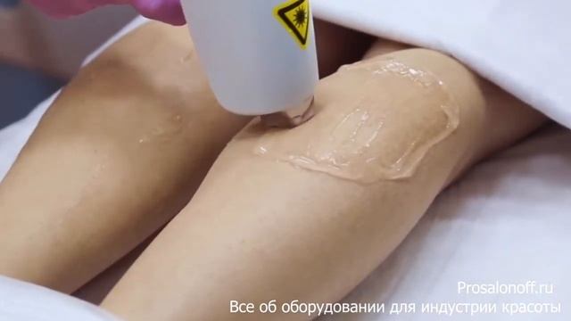 In Motion D2 - аппарат для лазерной эпиляции смотреть онлайн