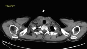 Базовая КТ анатомия органов грудной полости