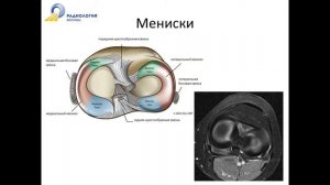 Базовый курс по МРТ «МР анатомия коленного сустава и методика сбора данных» Лектор Катков А М