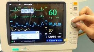 Mindray Monitor Demonstration