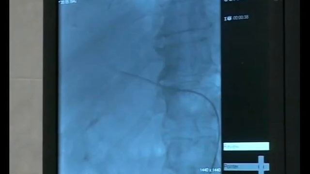 Лечение злокачественных опухолей печени. смотреть онлайн