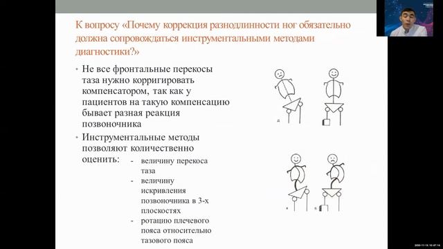 Алгоритм обследования синдрома короткой ноги. Валиев В.К. смотреть онлайн