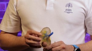 Опухоль почки или киста? Как поставить правильный диагноз