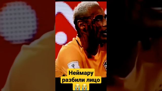 Неймару разбили лицо 😭😭 смотреть онлайн