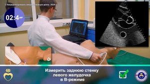 Трансторакальная эхокардиография. Парастернальный доступ – длинная ось левого желудка