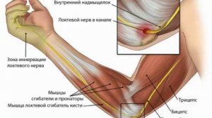 УЗД невропатии локтевого нерва