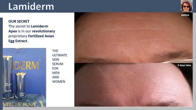 See, what LAMIDERM can do for you ... смотреть онлайн