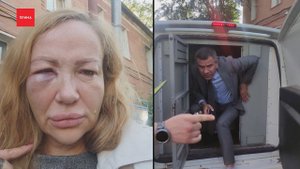 Депутата Андрея Новака подозревают в истязании сожительницы