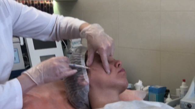 Урок красоты Ирины Аксененко №32. векторный лифтинг препаратом Радиес смотреть онлайн