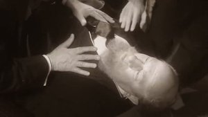 ОН ЕЩЁ ТАНЦУЕТ? Преображенский СОБАЧЬЕ СЕРДЦЕ М. Булгакова