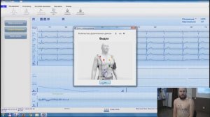 Методические «секреты» мониторирования в 12 отведениях
