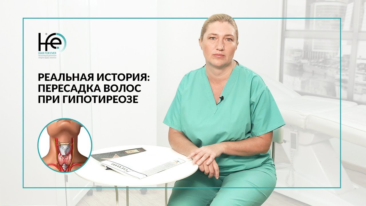 История пациента: Восстановление волос в 52 года | HFE Clinic 6+