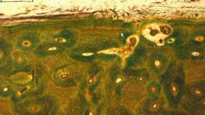 Диафиз трубчатой #кости (поперечный срез)