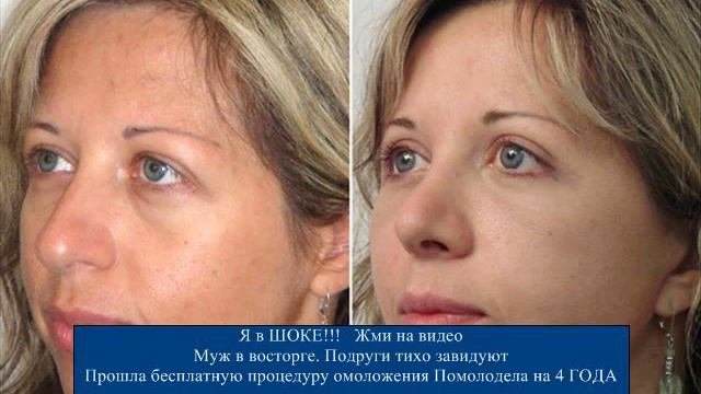 Watch У Вас Морщины? Избавляемся От Морщин На Лице За 12 Минут - Морщины На Лице