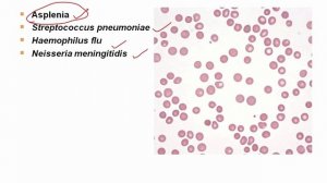 USMLE RX - 7.Микробиология - 2.Основы бактериологии - 11.Инкапсулированные бактерии
