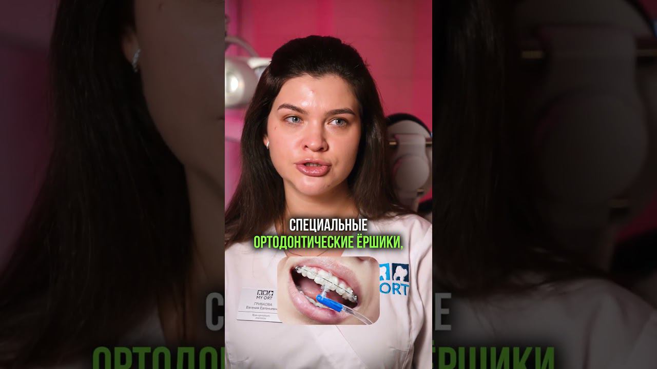 Что нужно знать перед установкой брекет системы?  #стоматология #стоматолог #брекеты