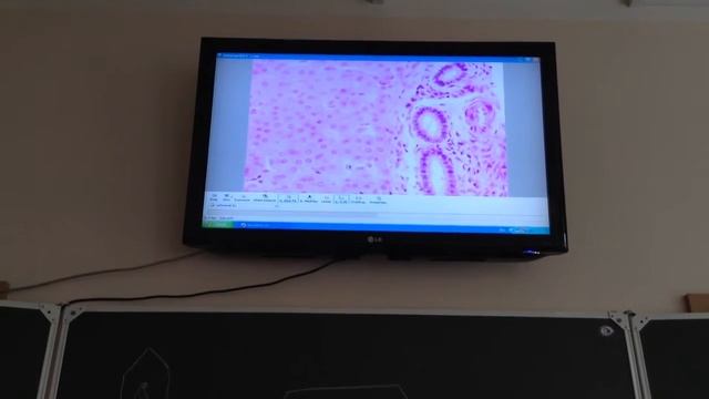 Гистология Печень человека [Пищеварительная система] смотреть онлайн