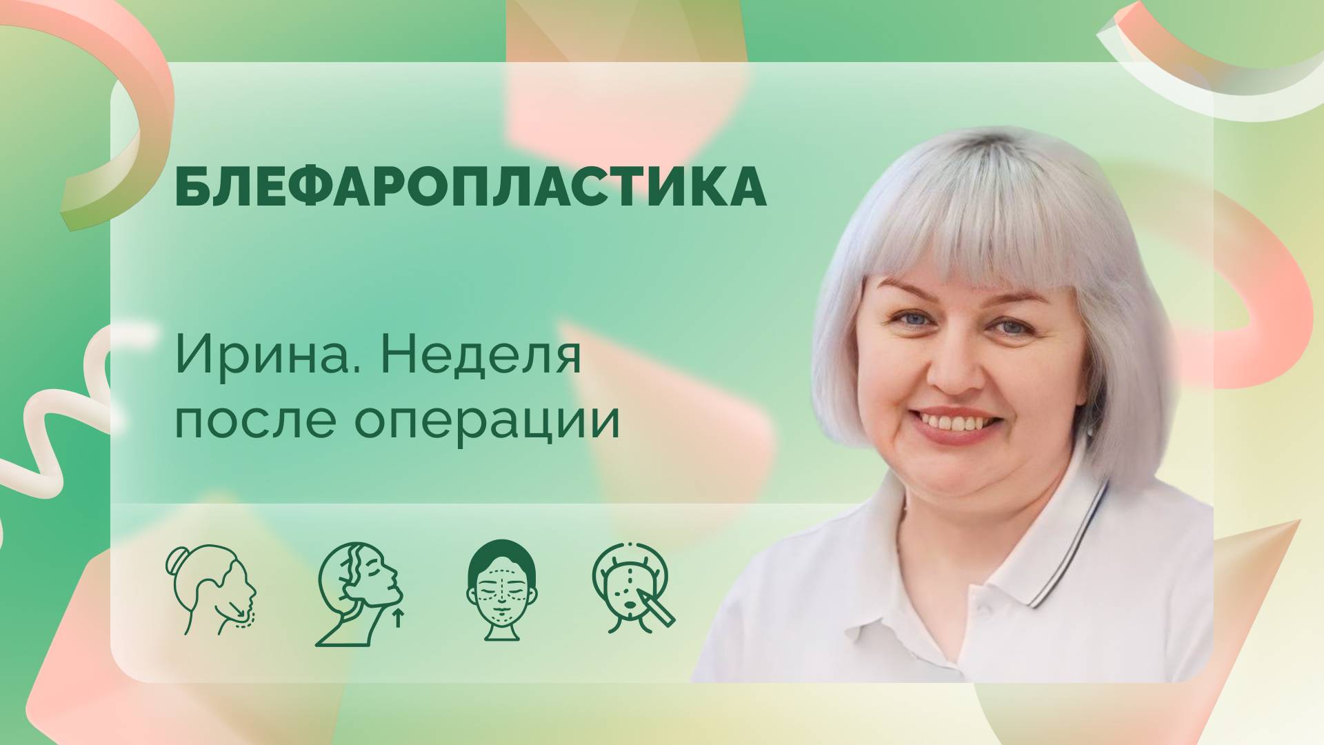 Ирина. Блефаропластика. Неделя после операции