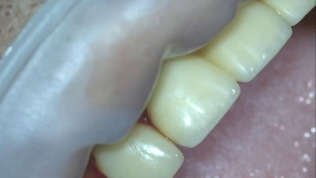 Диагностика трещины корня смотреть онлайн