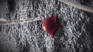 Как приживается имплантант