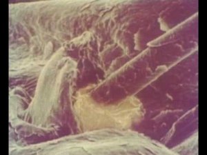 Волосы человека