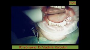 Cеанс лазеротерапии Ик+Кр . область 33 37.