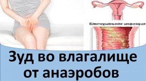 Зуд во влагалище от анаэробов.