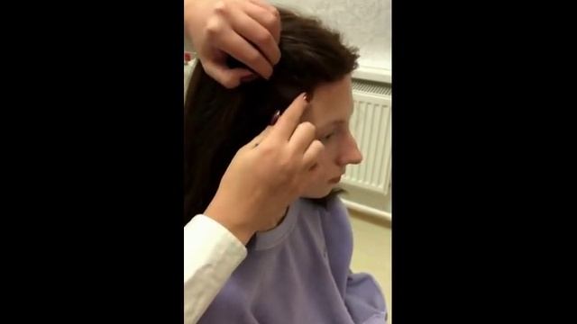 Установка системы волос
