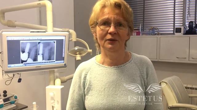 Имплантация Astra Tech и металлокерамические коронки смотреть онлайн