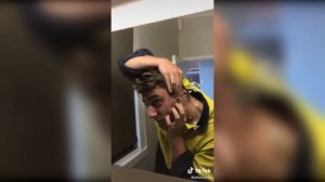 Popping huge blackheads and Giant Pimples - Best Pimple Popping Videos #77