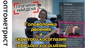История исчезающего двоения. Скрытое косоглазие в прошлом