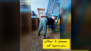 Spinraza, spinal muscular atrophy, SMA, Спинраза, Нусинерсен, Спинальная мышечная атрофия, СМА