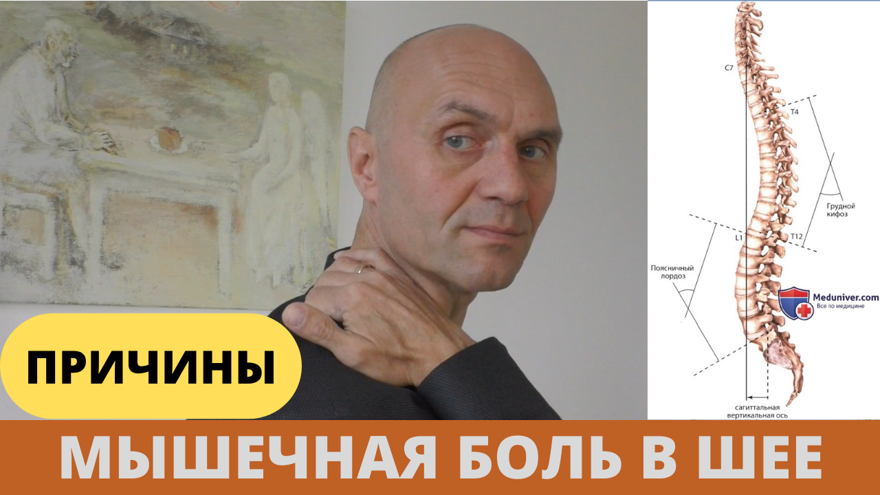 МЫШЕЧНАЯ БОЛЬ В ШЕЕ. ПРИЧИНЫ И ПРОФИЛАКТИКА (часть 1)