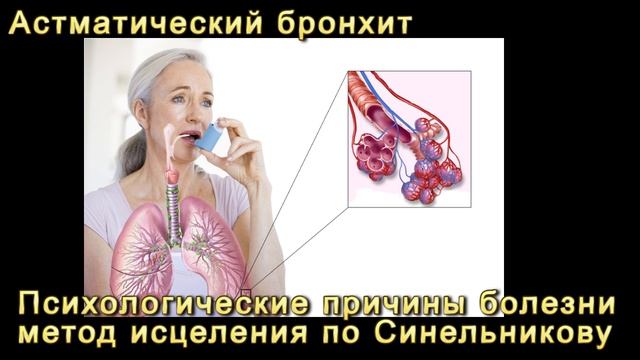 астматический бронхит