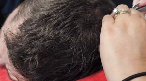 ASMR Real person Fast and Aggressive Scalp treatment, head treatment and head scratches!