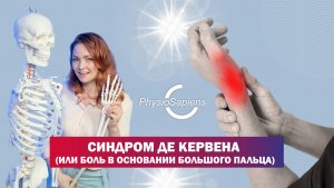 Синдром де Кервена или боль в основании большого пальца