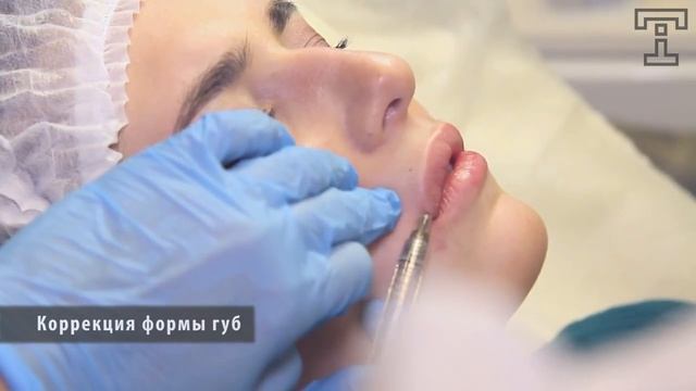 Клиника TORI Коррекция губ смотреть онлайн