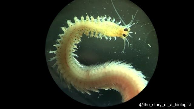 Процесс Заживления Раны смотреть онлайн