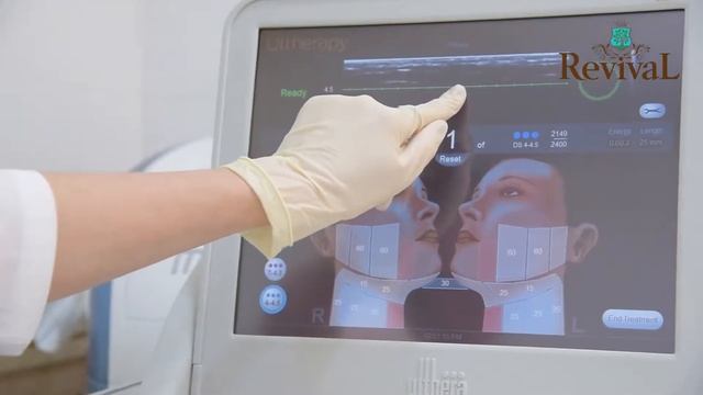 Аппаратная косметология/ Ulthera System (SMAS-лифтинг) смотреть онлайн