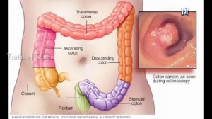 Effects of calcium deficiency & food sources of calcium | Health series-2