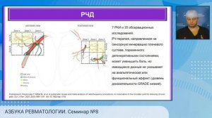 АЗБУКА РЕВМАТОЛОГИИ. Семинар №8