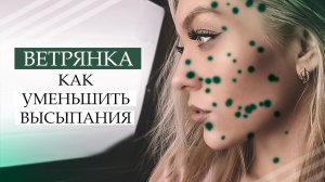 ВЕТРЯНКА У ВЗРОСЛЫХ / КАК Я УМЕНЬШИЛА ВЫСЫПАНИЯ И БЫСТРО ВЫЛЕЧИЛАСЬ