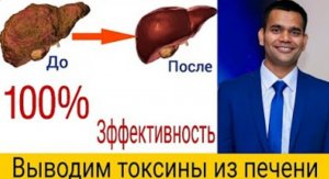 Кожные Признаки_ Говорящие О Том_ Что Ваша Печень В Беде