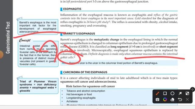 GIT PATHOLOGY//MBBS 2ND YEAR//ESOPHAGEAL PATHOLOGY ? ?//notes смотреть онлайн