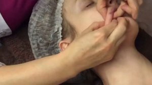 Скульптурно-буккальный массаж