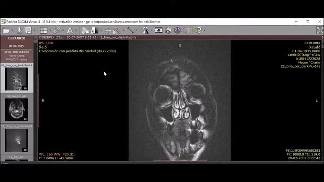 RadiAnt DICOM viewer