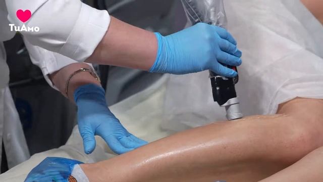 ТиАмо Эпиляция Moveo смотреть онлайн