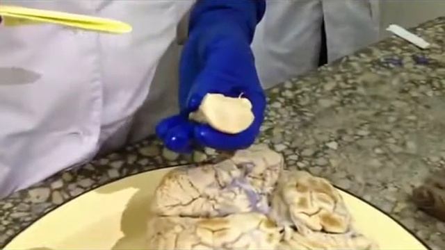 Анатомическое строение головного мозга. #анатомия #медицинскийканал #медсестра #медицина #мозг