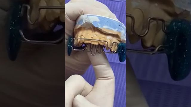 Аппарат Планас