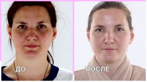 Перезагрузка: Как правильно ухаживать за кожей лица